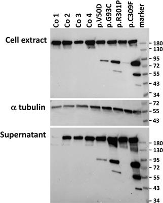 Degradation of collagen I by activated C1s in periodontal Ehlers-Danlos Syndrome